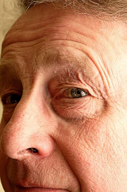 Photo of a senior man focused on the eye Photo of a senior man focused on the eye.