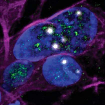 Cryptic exons in nuclei with TDP-43 knockdown Bright white spots in nuclei with TDP-43 knockdown